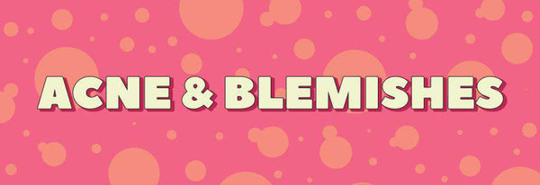 Acne &amp; Blemishes