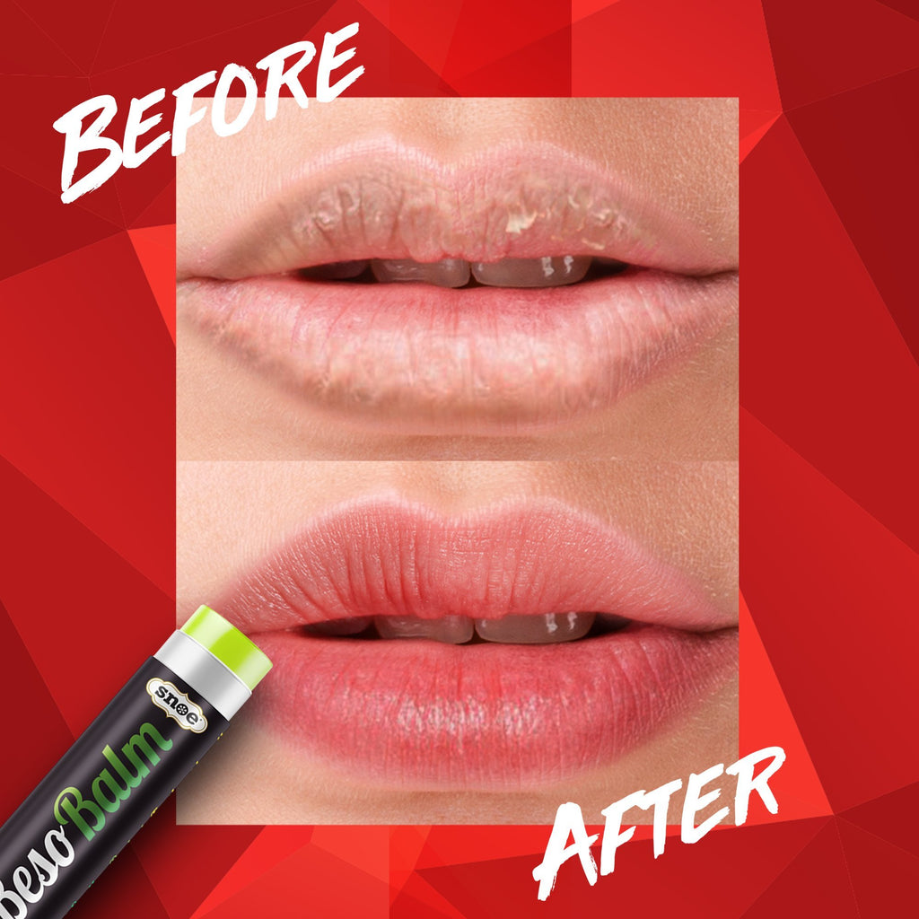 A picture showcasing the transformative effects of BESOBALM lip balm on a woman's lips in terms of beauty and skincare.