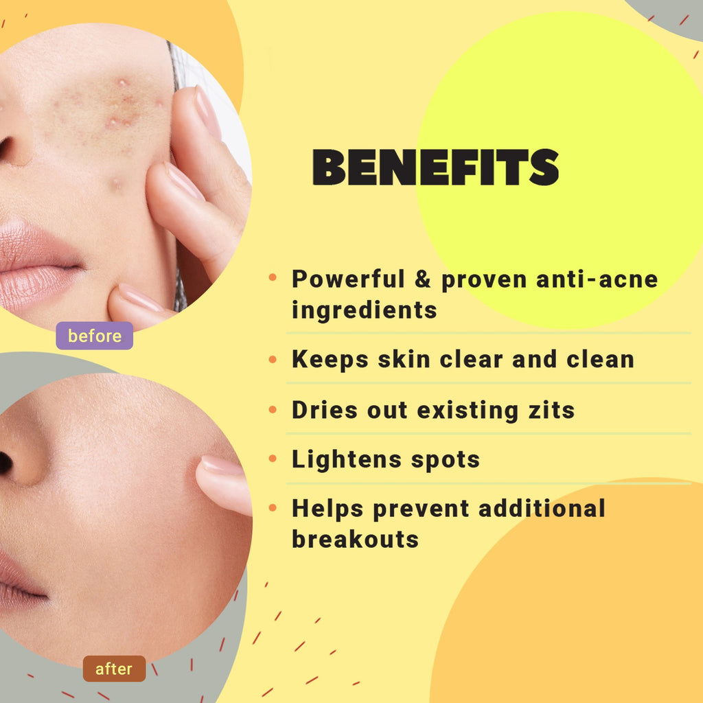 Skin Care - Spot On Spot Off Acne Fading Gel Serum
